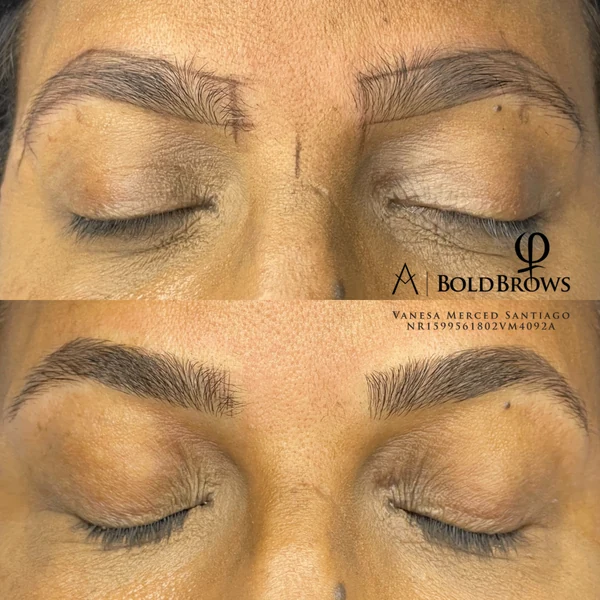 Natural Results — Classic